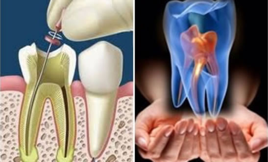 endodontia-1